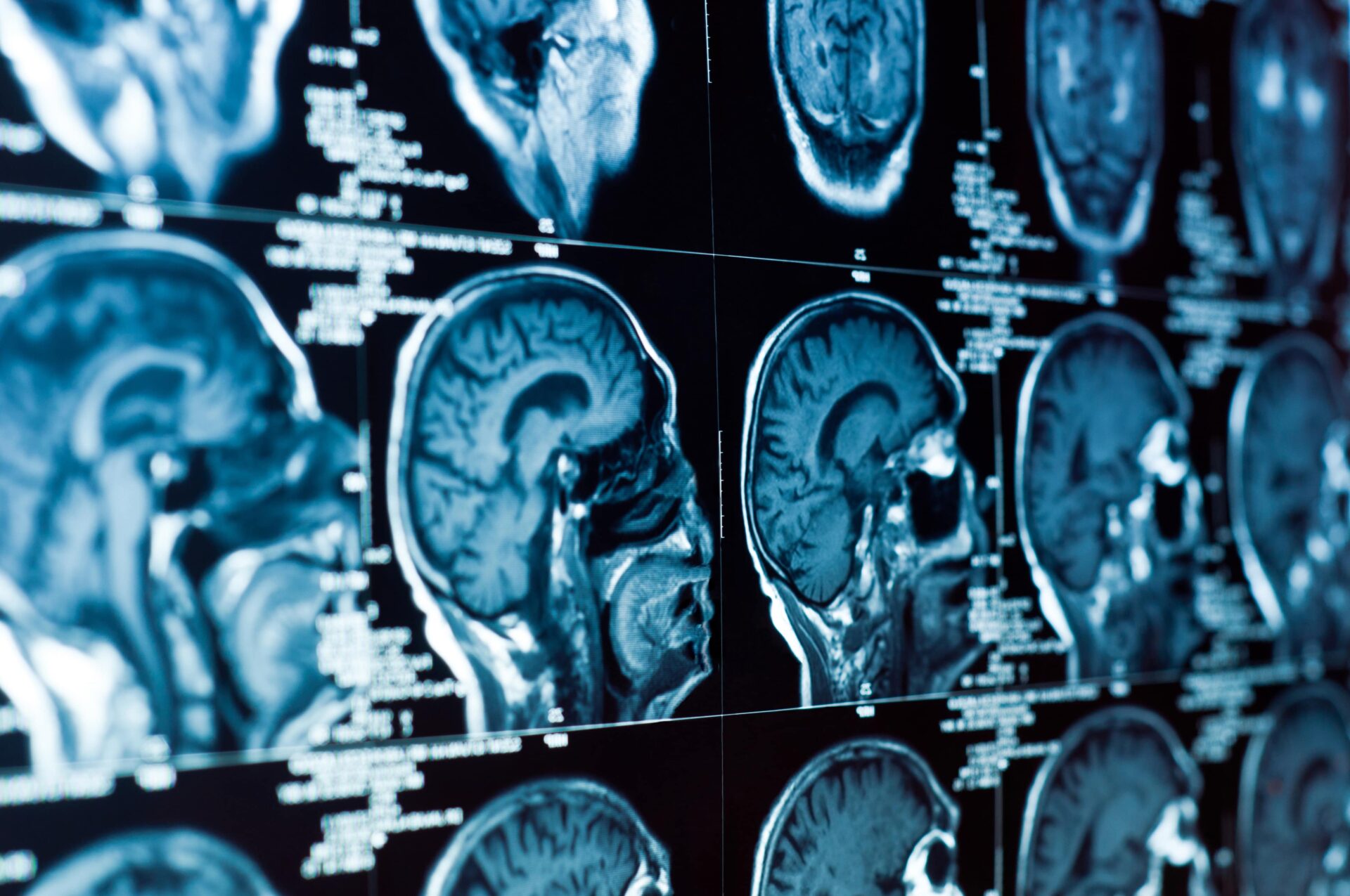 Understanding Brain Injuries: A FAQ Guide